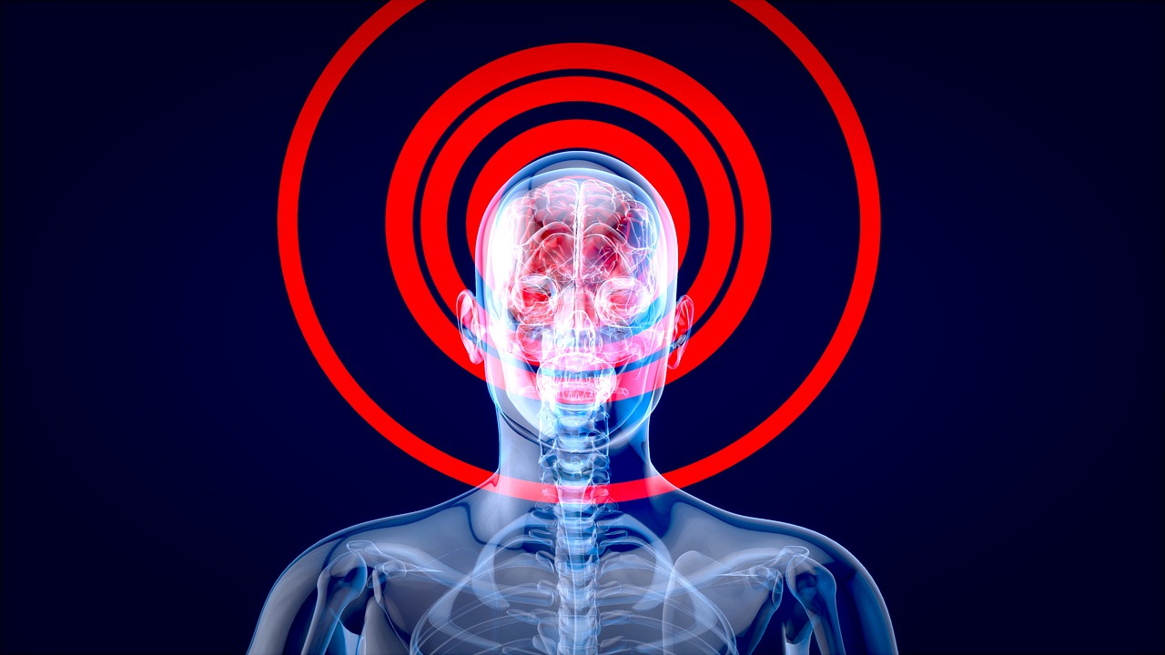 Brain Psychology Concept Man - julientromeur / Pixabay